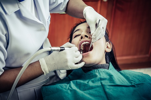 Aesthetic Filling (Bonding) treatment antalya
