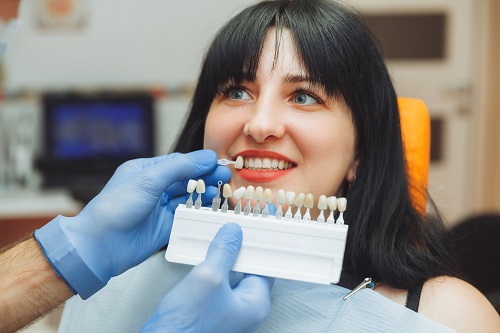 Laminate Veneers